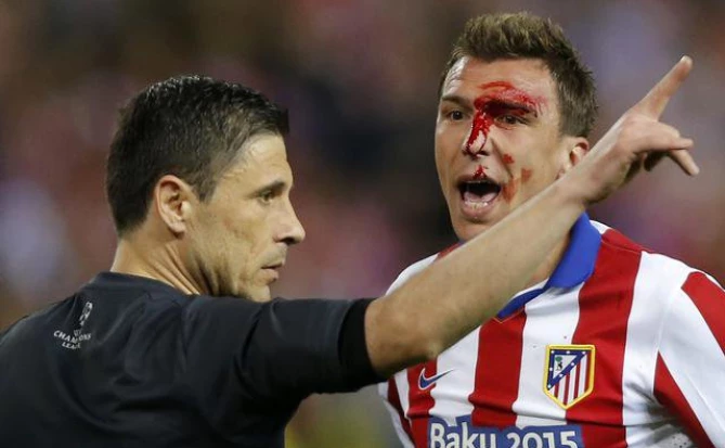 BETA/AP Photo/Daniel Ochoa de Olza