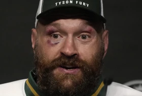 Fjuri: "Džošua ne želi frku, bio je šokiran"