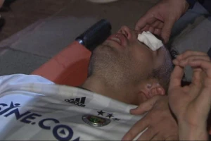 Stravična povreda Van Perisija, oštećen mu je vid!