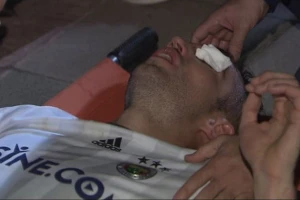 Oglasio se i Van Persi posle opasne povrede!
